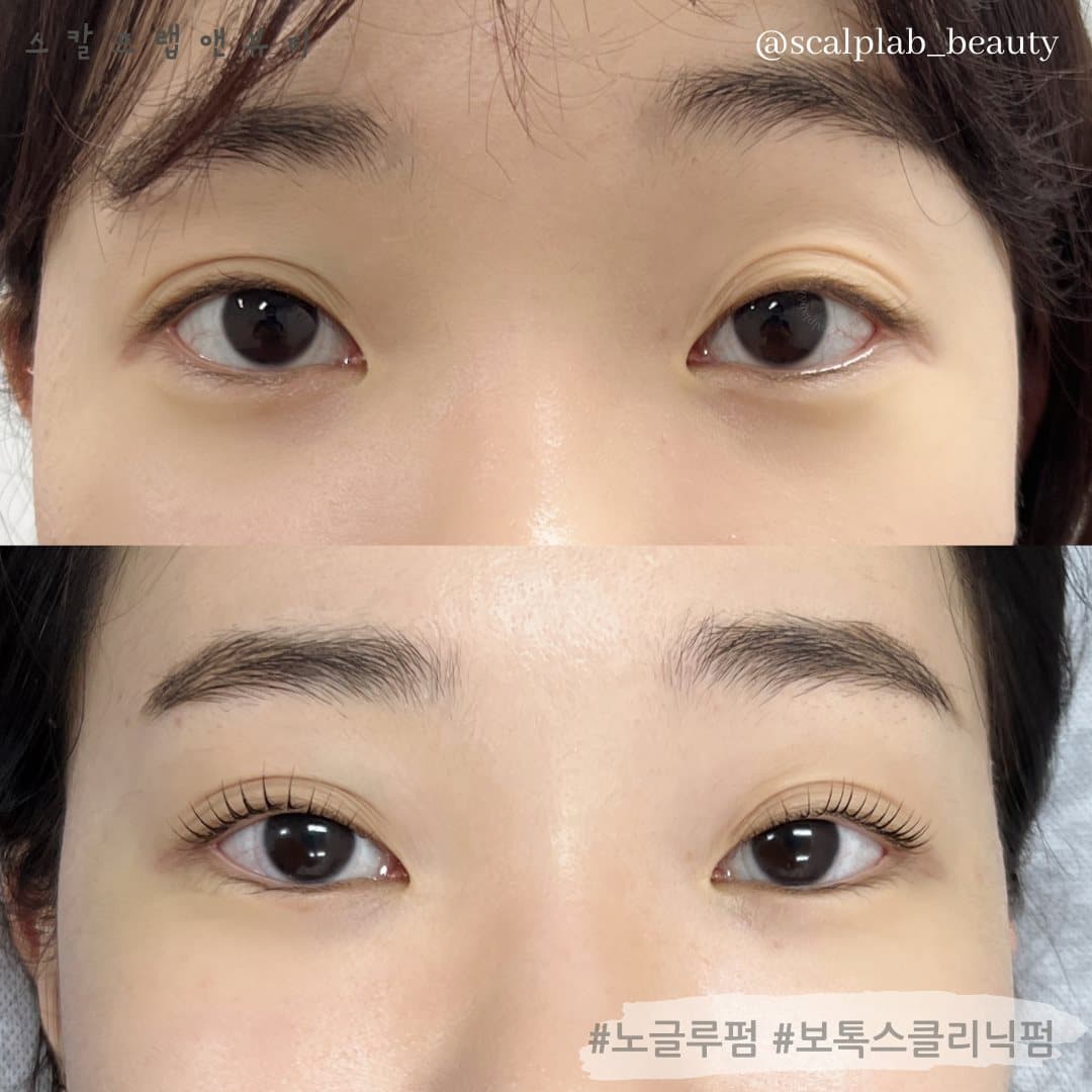 속눈썹펌 전·후