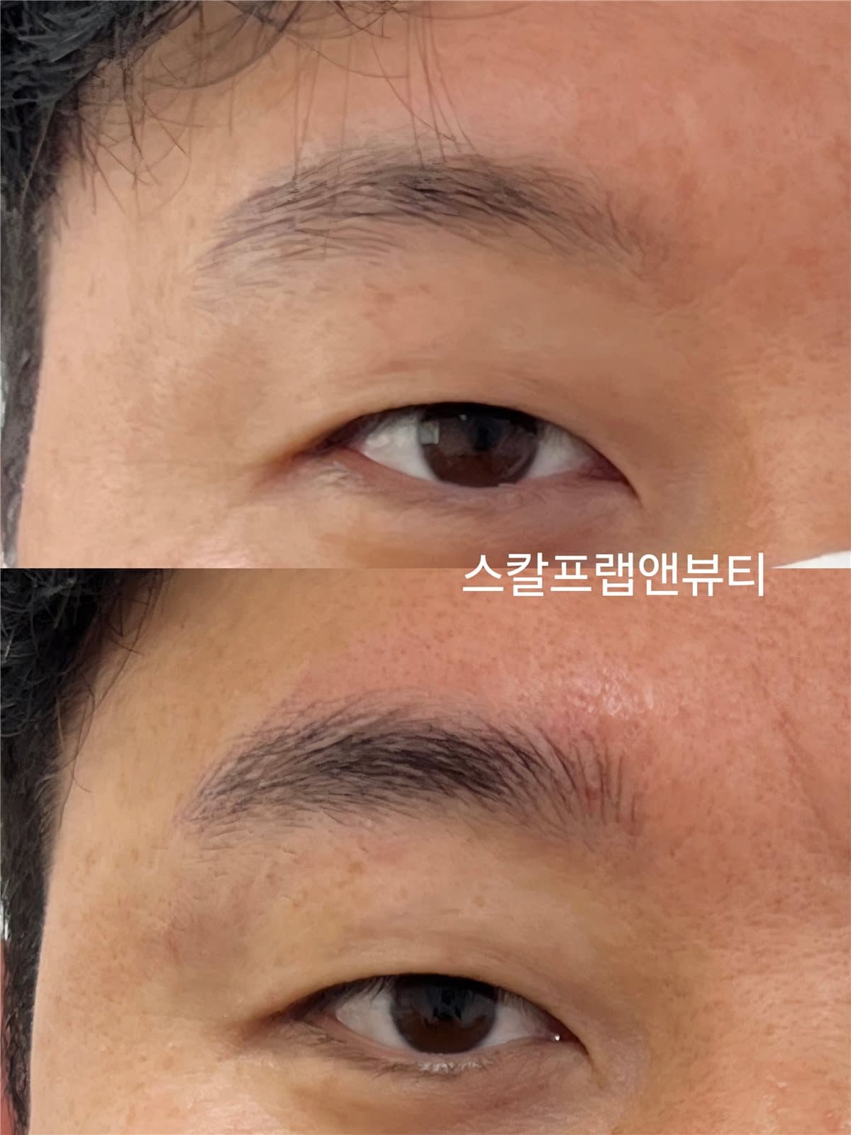 극사실눈썹 · 전·후 비교